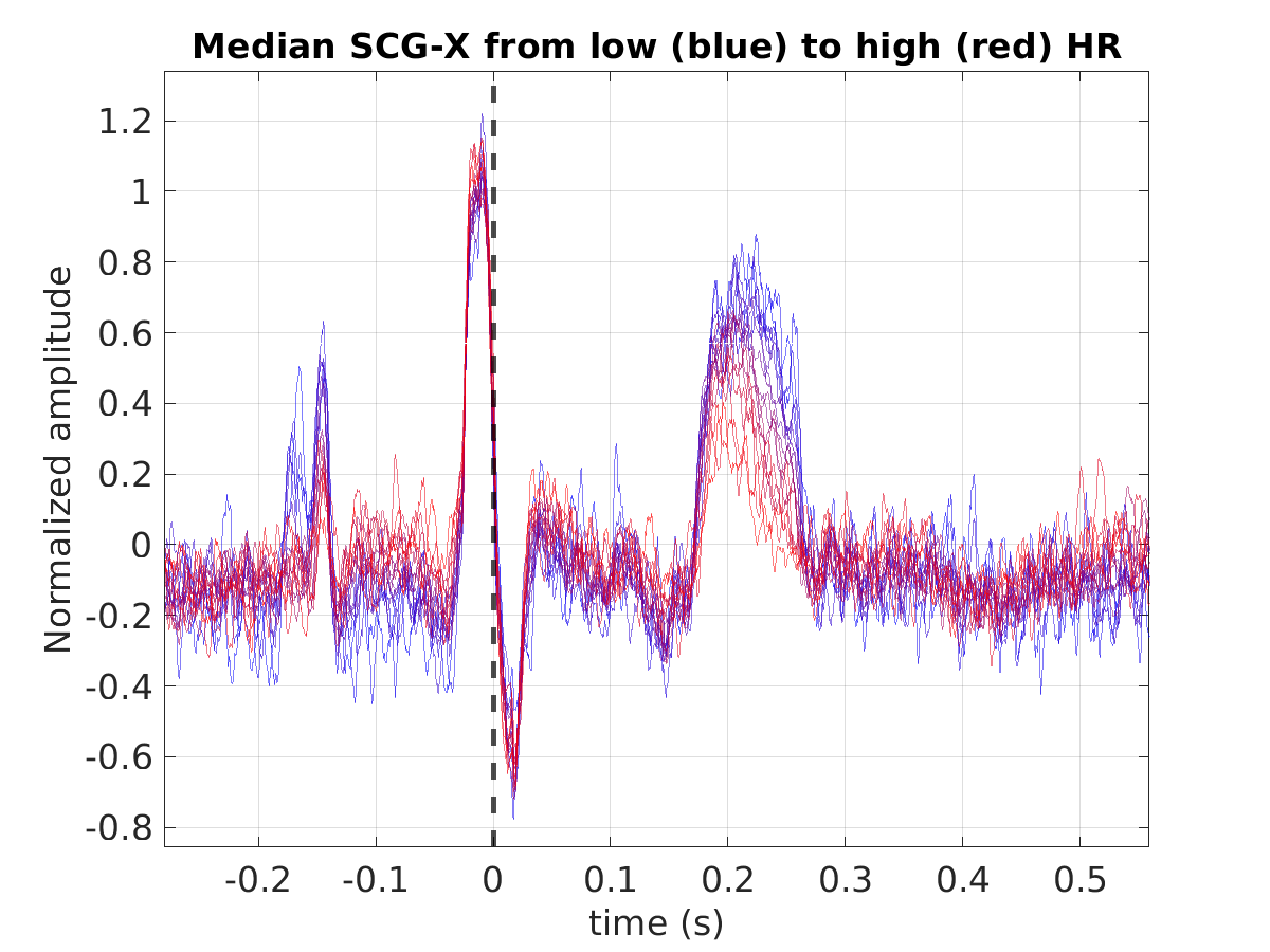 S028_scg_med_scgx_hr_binned_norm