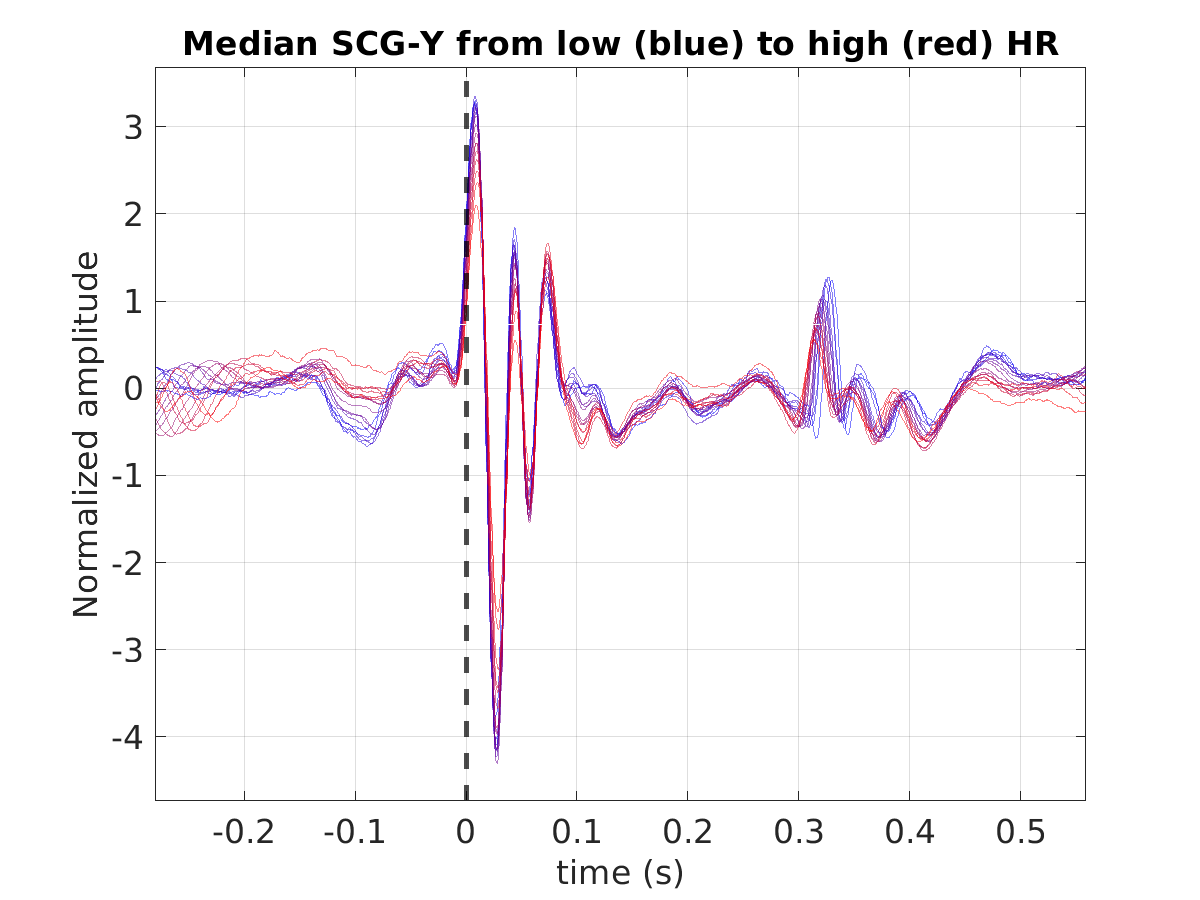 S028_scg_med_scgy_hr_binned_norm