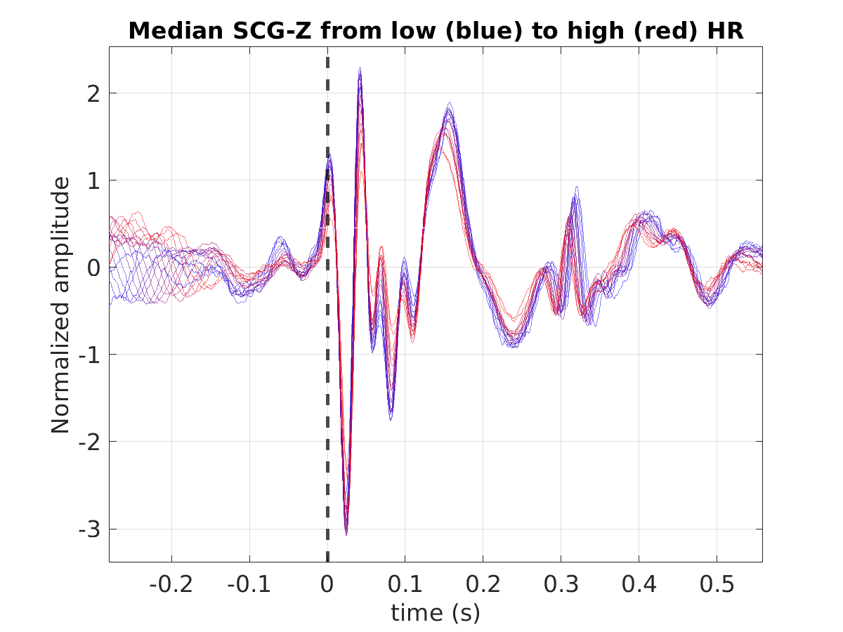 S028_scg_med_scgz_hr_binned_norm