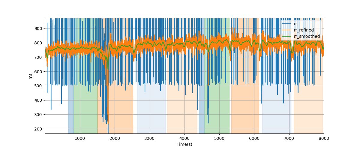 RR intervals - Overlay