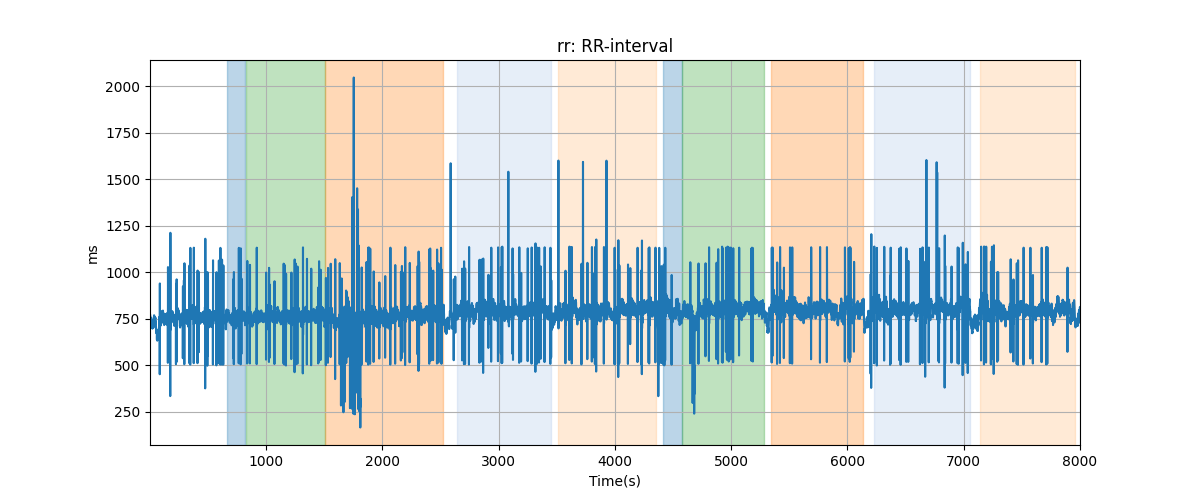 rr: RR-interval