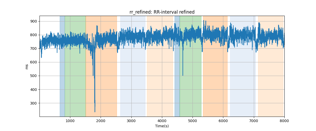 rr_refined: RR-interval refined