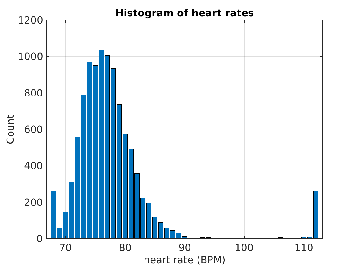 S029_ecg_hr_hist