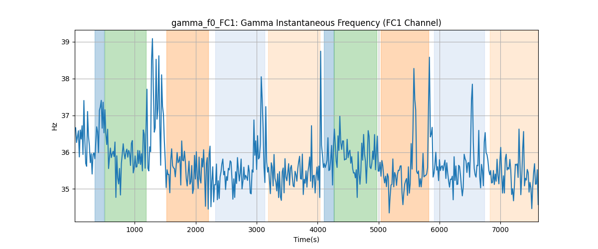 gamma_f0_FC1: Gamma Instantaneous Frequency (FC1 Channel)