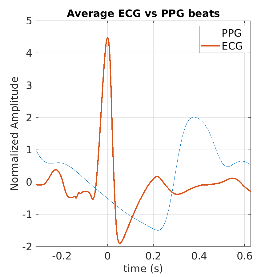 S029_ppg_avg_ecg_ppg