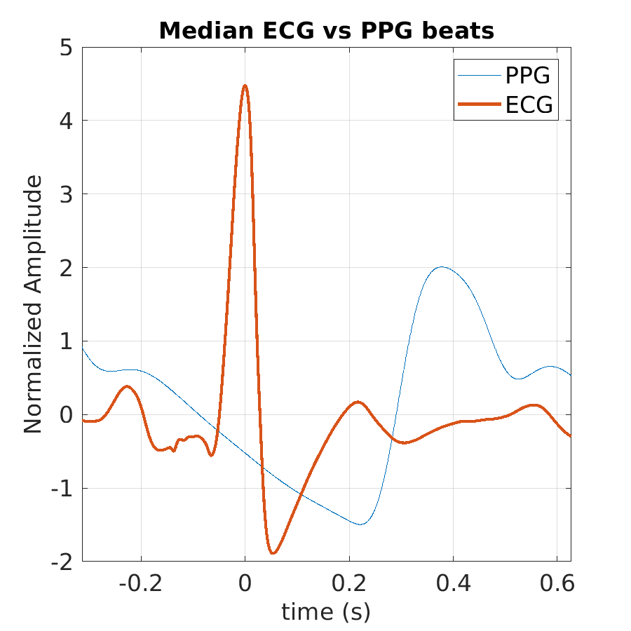 S029_ppg_med_ecg_ppg