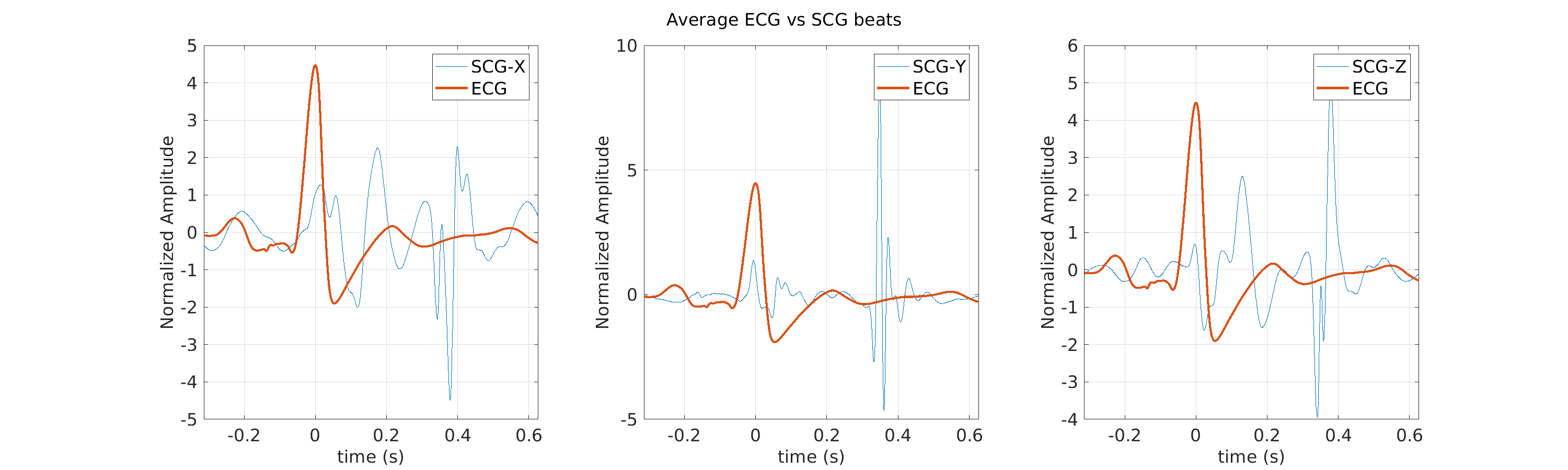 S029_scg_avg_ecg_scg