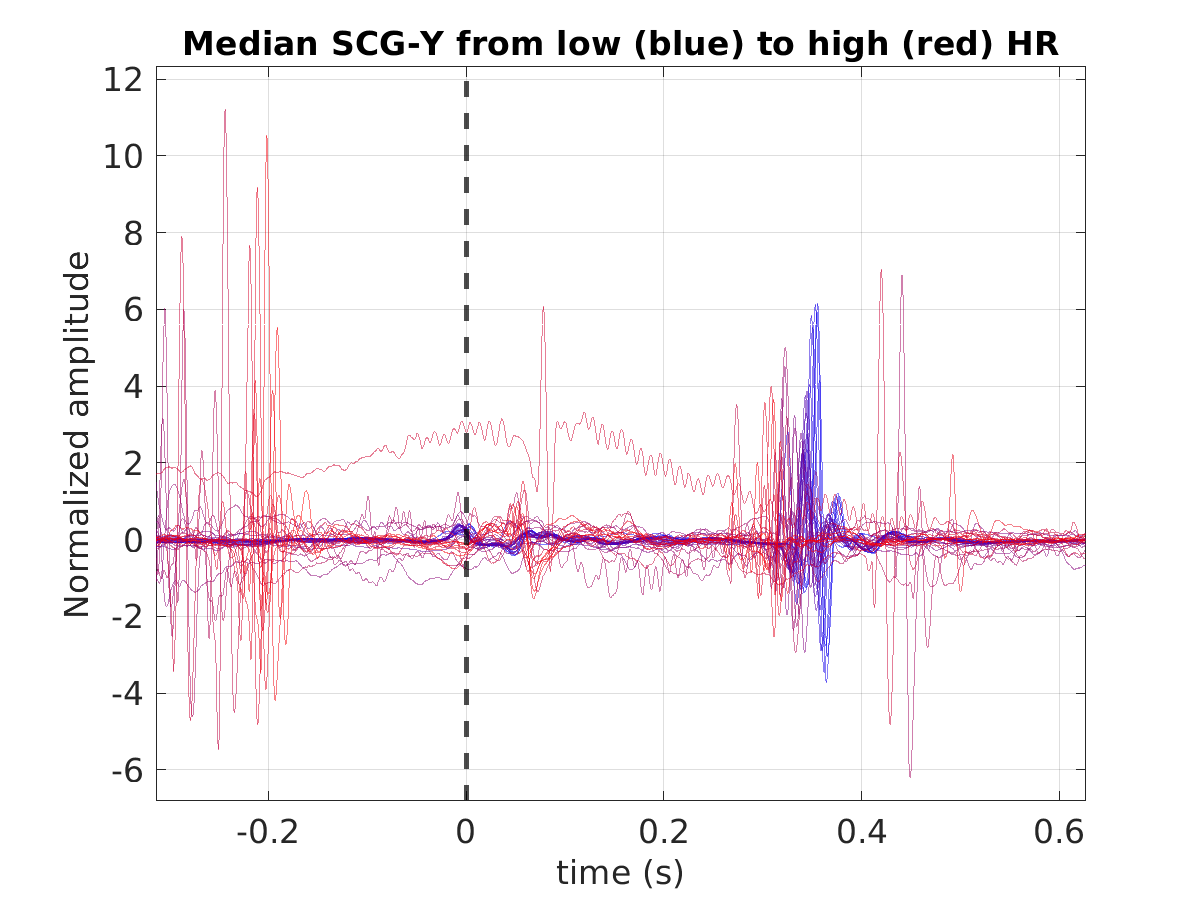 S029_scg_med_scgy_hr_binned_norm