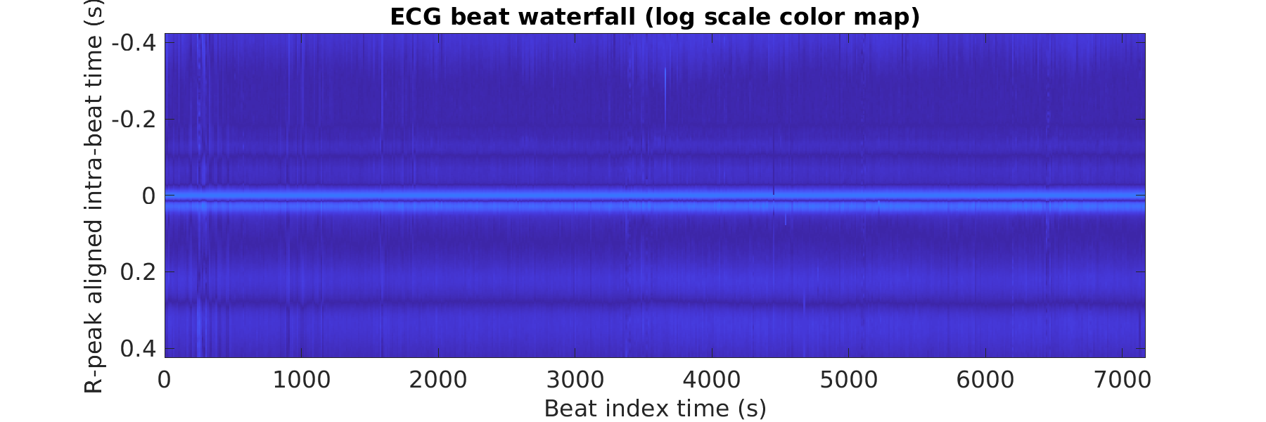 S040_ecg_beats_waterfall_logscale