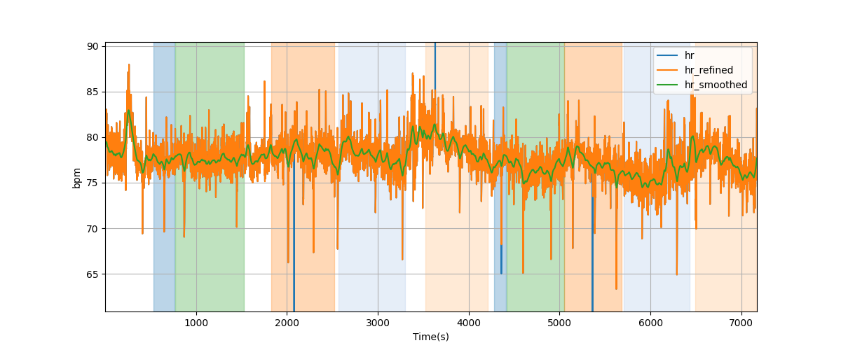 Heart rate - Overlay