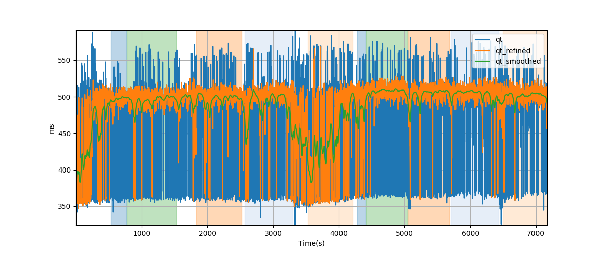 QT intervals - Overlay