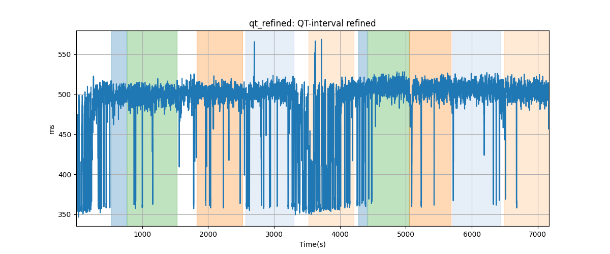 qt_refined: QT-interval refined