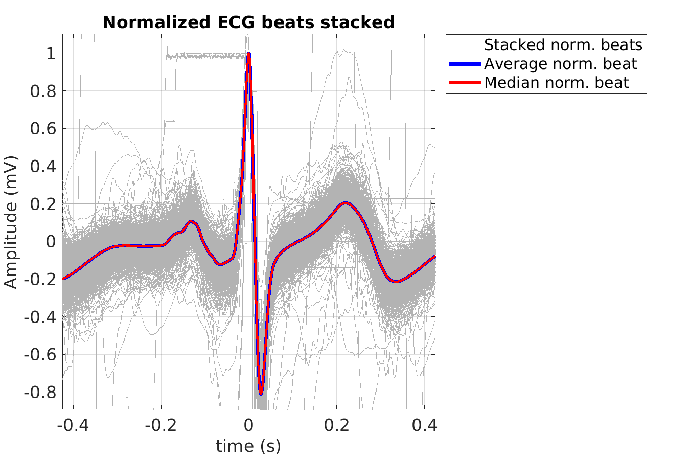 S040_ecg_norm_beats_stacked