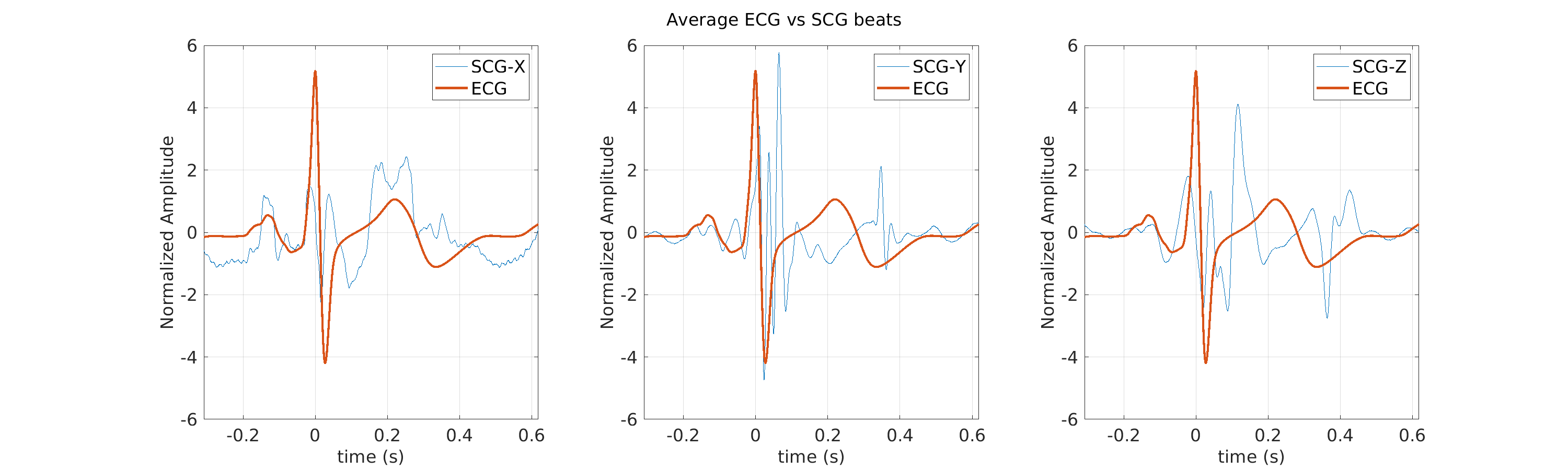 S040_scg_avg_ecg_scg