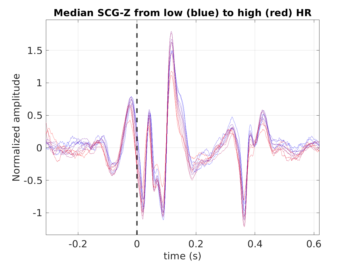 S040_scg_med_scgz_hr_binned_norm