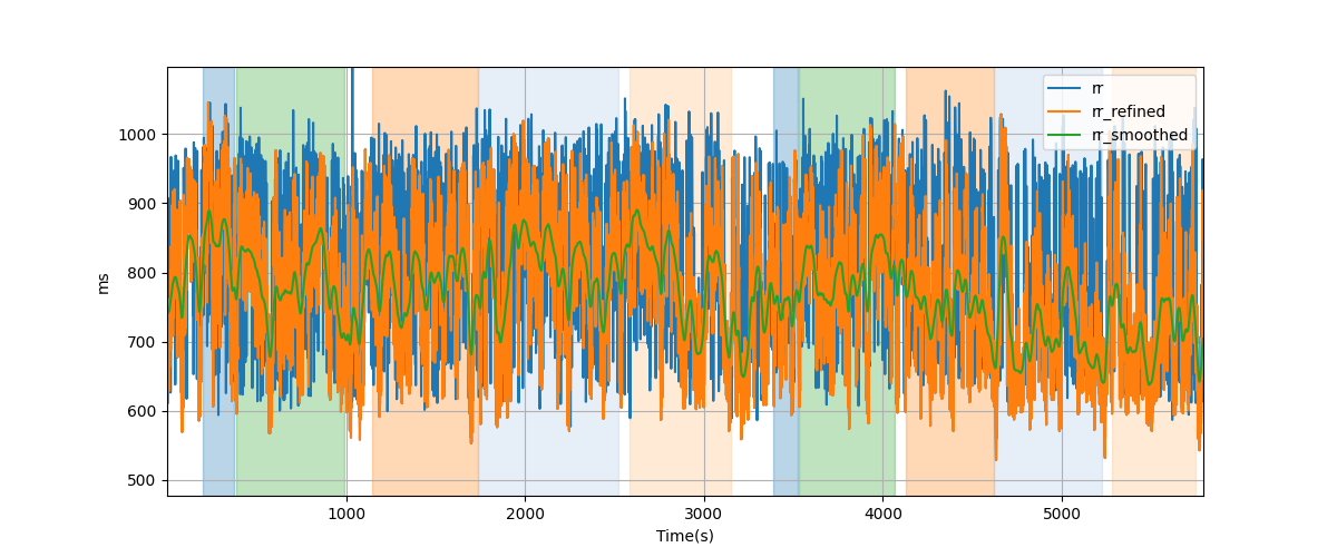 RR intervals - Overlay