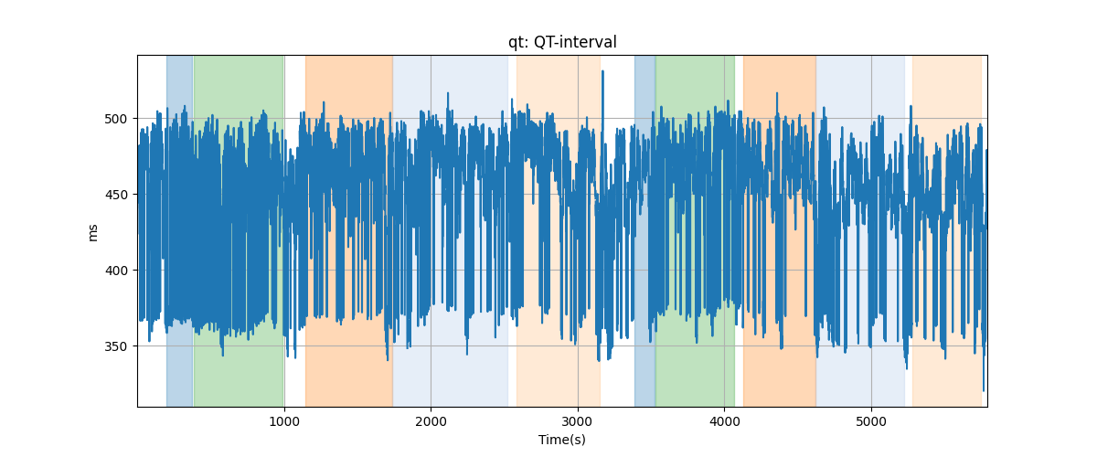 qt: QT-interval