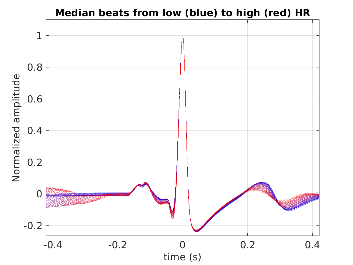 S043_ecg_med_beats_hr_binned