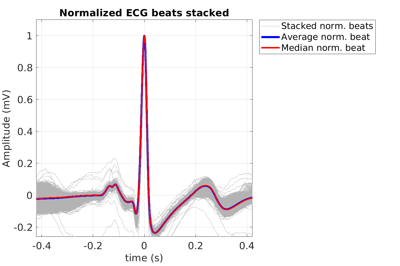 S043_ecg_norm_beats_stacked