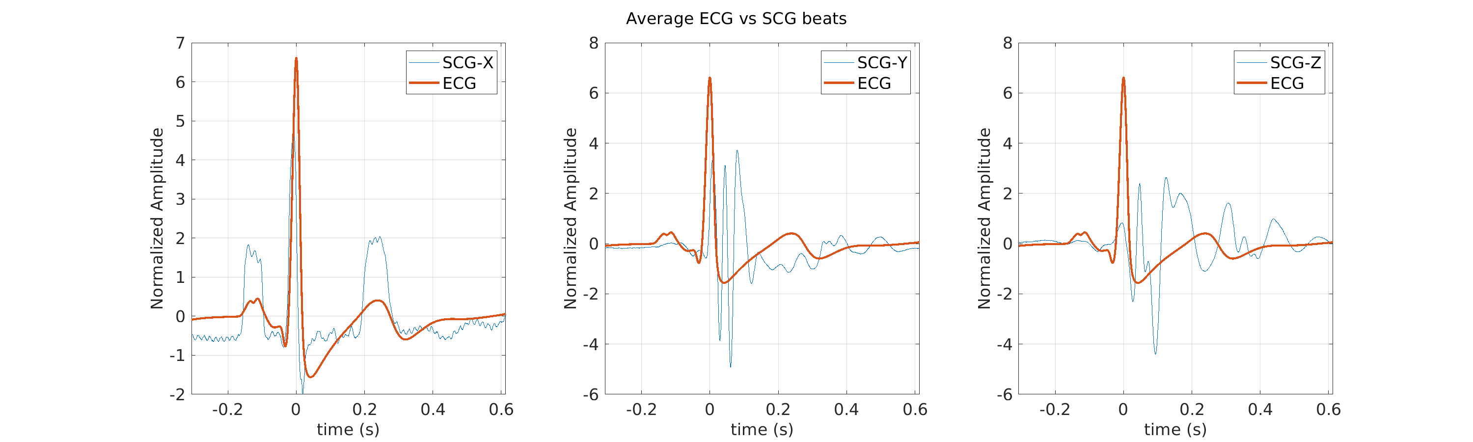 S043_scg_avg_ecg_scg