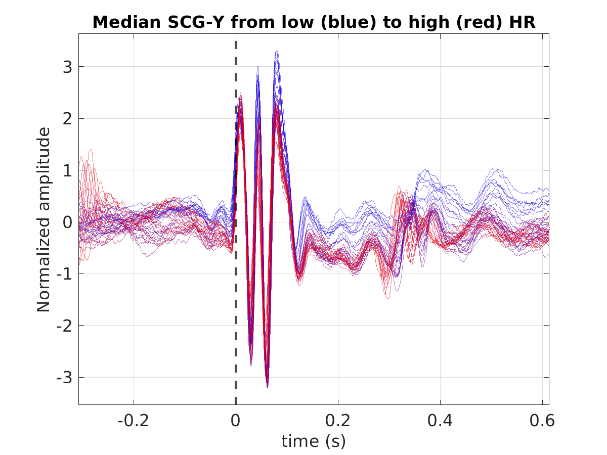 S043_scg_med_scgy_hr_binned_norm