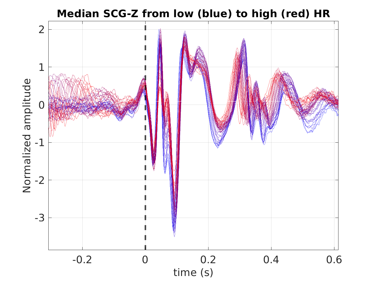 S043_scg_med_scgz_hr_binned_norm